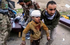 Mosul-RefugeesBloodyKidBandageHead