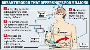 Paraplegic-breakthrough-diagram